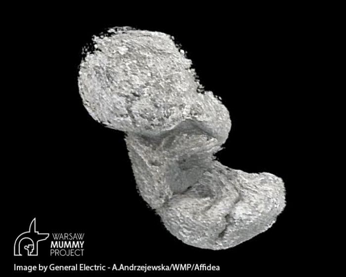 Płód w mumii, fot. General Electric-A. Andrzejewska/WMP/Affidea
