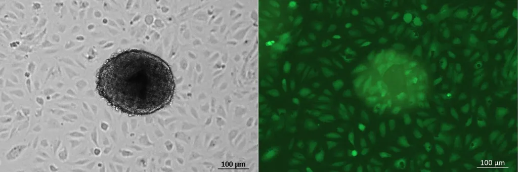 Źródło: Kinga Kamińska, Justyna Gogola [CC BY 4.0] via Wikimedia Commons