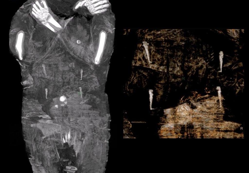 Środkowa część mumii z widocznymi czterema amuletami przedstawiającymi tak zwanych Synów Horusa (autor: Warsaw Mummy Project)