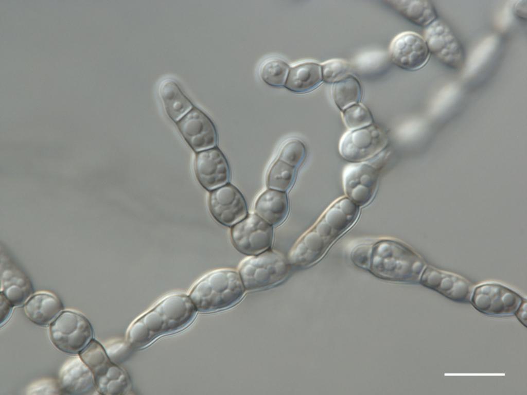 Formicomyces microglobosus ined. Bar = 10 um 3. Fot.  M.Piątek & I. Siedlecki