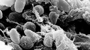 Yersinia pestis. Fot. Wikipedia/ domena publiczna