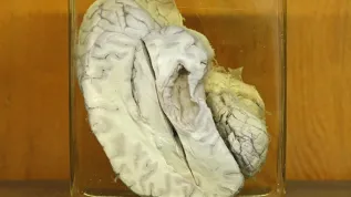 Mózg w pracowni anatomii Uniwersytetu Medycznego w Białymstoku, Muzeum Historii Medycyny i Farmacji, PAP/Artur Reszko (ar/awol)