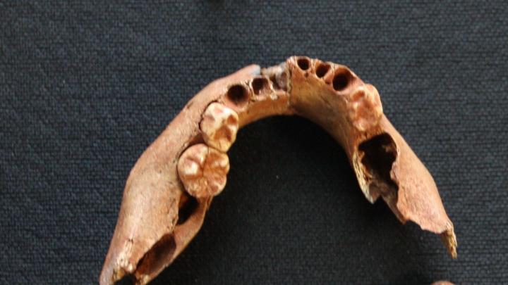 Szczęka i zęby 3-letniego dziecka odkrytego w Pierkunowie-Giżycku, fot. Zdjęcie materiałów zębowych dziecka (3 letniego) z Pierkunowo-Giżycko, fot. J. Tomczyk