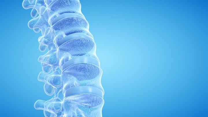 Un implant spinal a restabilit cu succes capacitatea de a merge la un pacient cu boala Parkinson