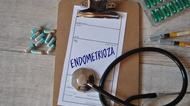 Lublin/ 160 pacjentek może zrobić szybki test na endometriozę