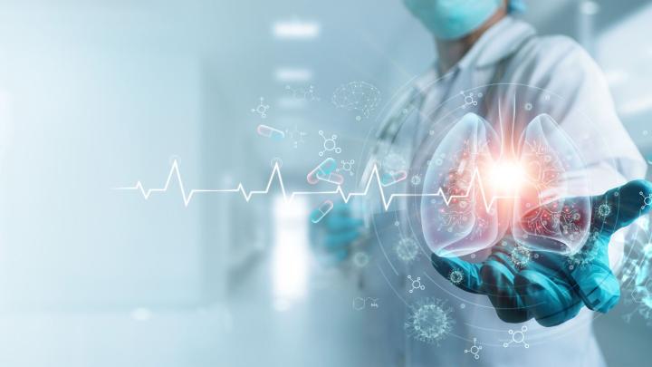 Eksperci: miejsce zamieszkania wciąż decyduje o dostępie do skutecznego leczenia raka płuca w Polsce