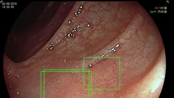 Polskie badanie: czy AI w medycynie może osłabić umiejętności lekarzy?