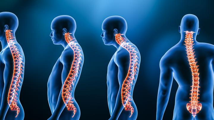 Polscy naukowcy współtwórcami gorsetu do leczenia skoliozy u młodzieży