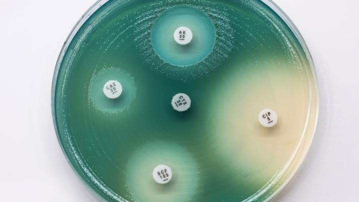 Gdańsk/ Naukowcy opracowali środek na pałeczkę ropy błękitnej