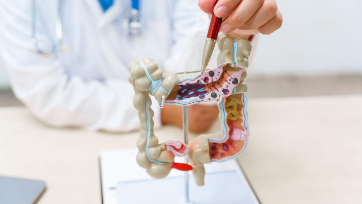 Eksperci: nowoczesne leczenie chorych na nieswoiste choroby zapalne jelit – korzystne dla pacjentów i opłacalne dla państwa