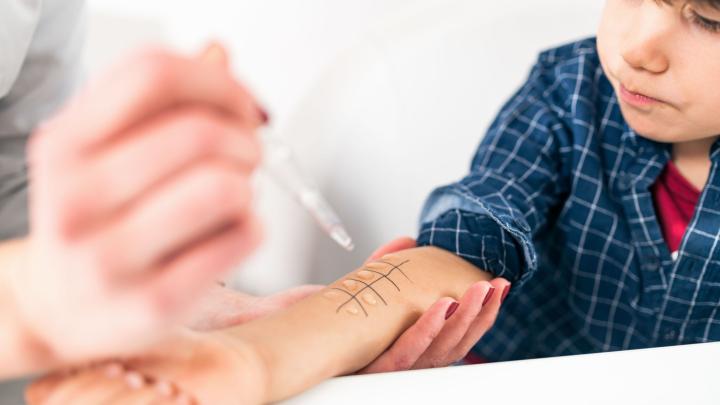 Ekspert: w alergii krzyżowej są objawy, których pacjent nie łączy z alergią