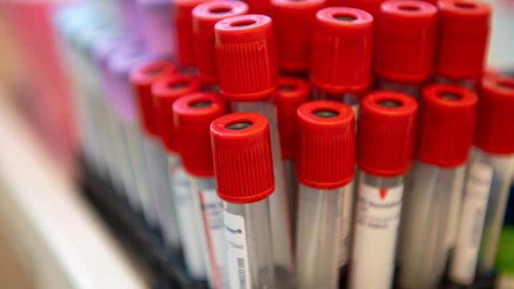 Hematolog: przewlekłe stany zapalne mogą sprzyjać nowotworom krwi