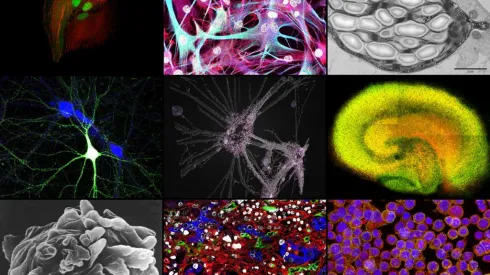 Europejski projekt BIO-IMAGINE wzmocnił potencjał badawczy Instytutu Biologii Doświadczalnej im. M. Nenckiego w Warszawie jako krajowego centrum kompetencji w dziedzinie bioobrazowania. Kolaż przedstawia zdjęcia komórek i tkanek wykonane za pomocą aparatury zakupionej w ramach projektu. Źródło: Instytut Nenckiego 