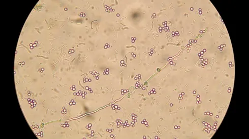 Mikroskopowy obraz candida albicans, fot. Adobe Stock