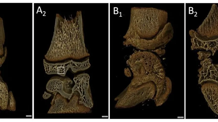 Wynik badania mikrotomografii komputerowej stawu kolanowego zwierząt zdrowych (A) i z osteoartrozą (B) przedstawiający zmiany w mikrostrukturze kości (m.in. ilości i grubości kości beleczkowych). Żrodło: Katarzyna Starowicz