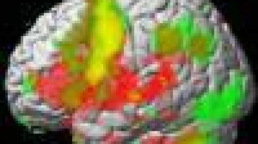 mozgfMRI.100.jpg