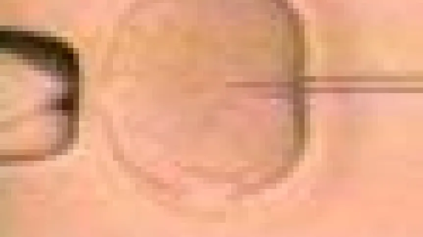 vitro.jpg