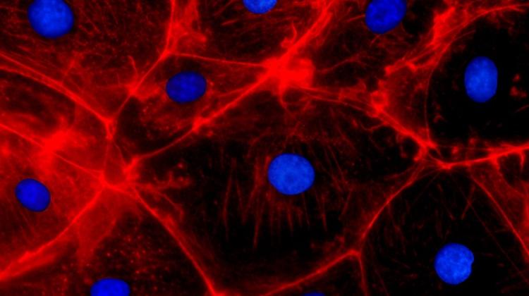 Zdjęcie komórek (zmodyfikowanych metodą CRISPR) wykonane przy użyciu konfokalnej mikroskopii fluorescencyjnej, Adobe Stock