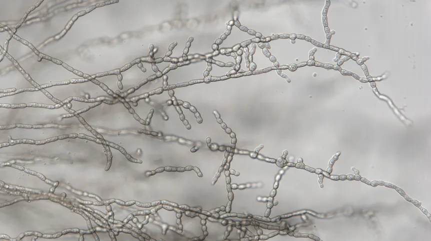 Formicomyces microglobosus ined. Bar = 50 um 1. Fot.  M.Piątek & I. Siedlecki