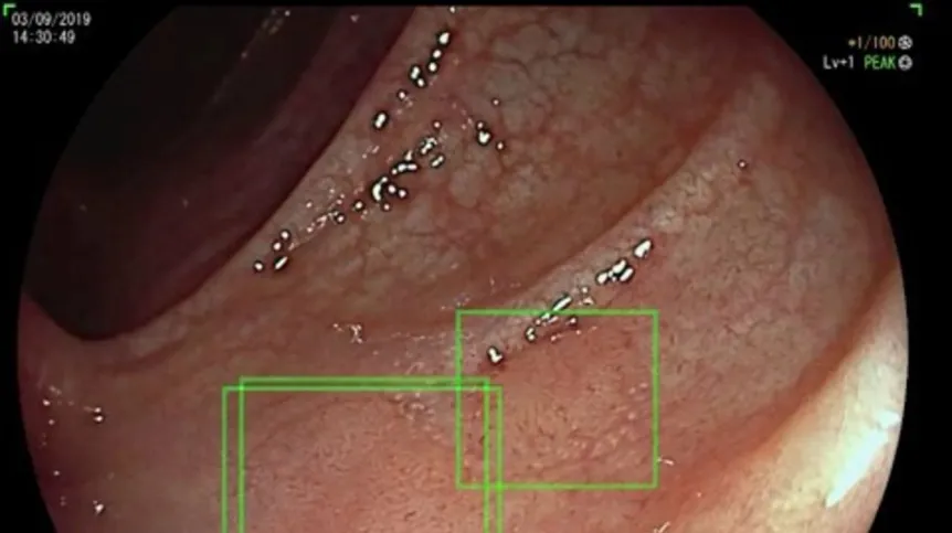 Fot. materiały prasowe