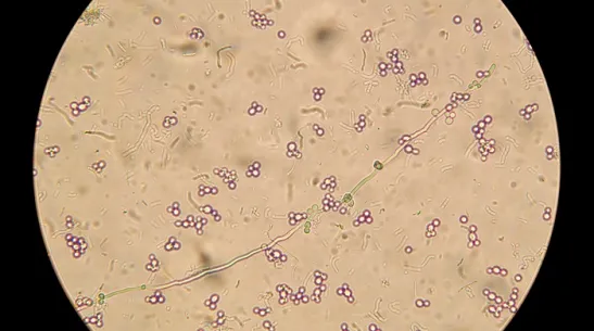 Mikroskopowy obraz candida albicans, fot. Adobe Stock