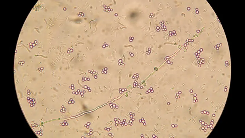 Mikroskopowy obraz Candida albicans, fot. Adobe Stock